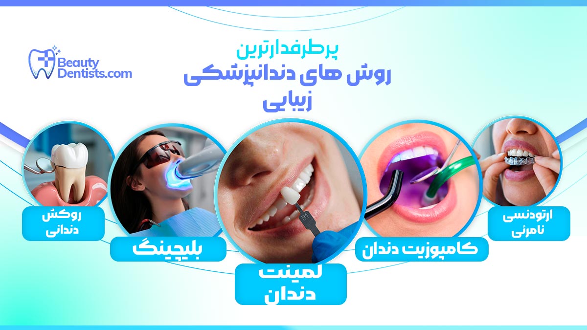 بهترین دندانپزشک زیبایی در شیراز + پرطرفدارترین روش های زیبایی دندان