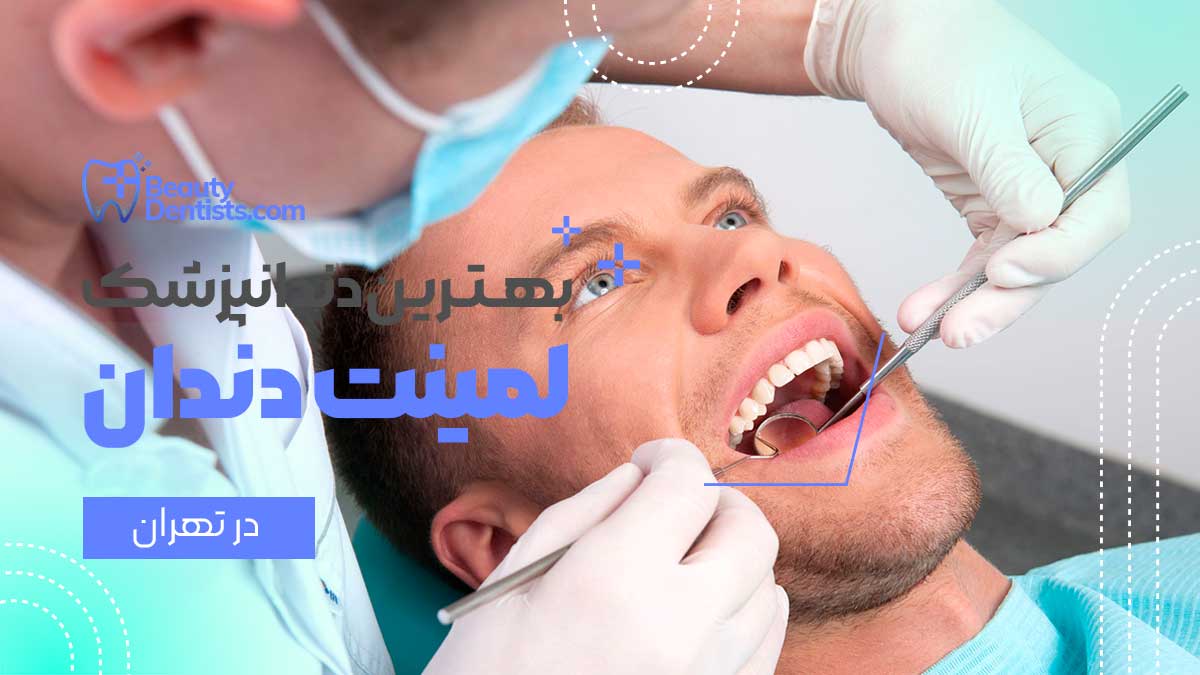 دندانپزشک لمینت دندان اقساطی در تهران