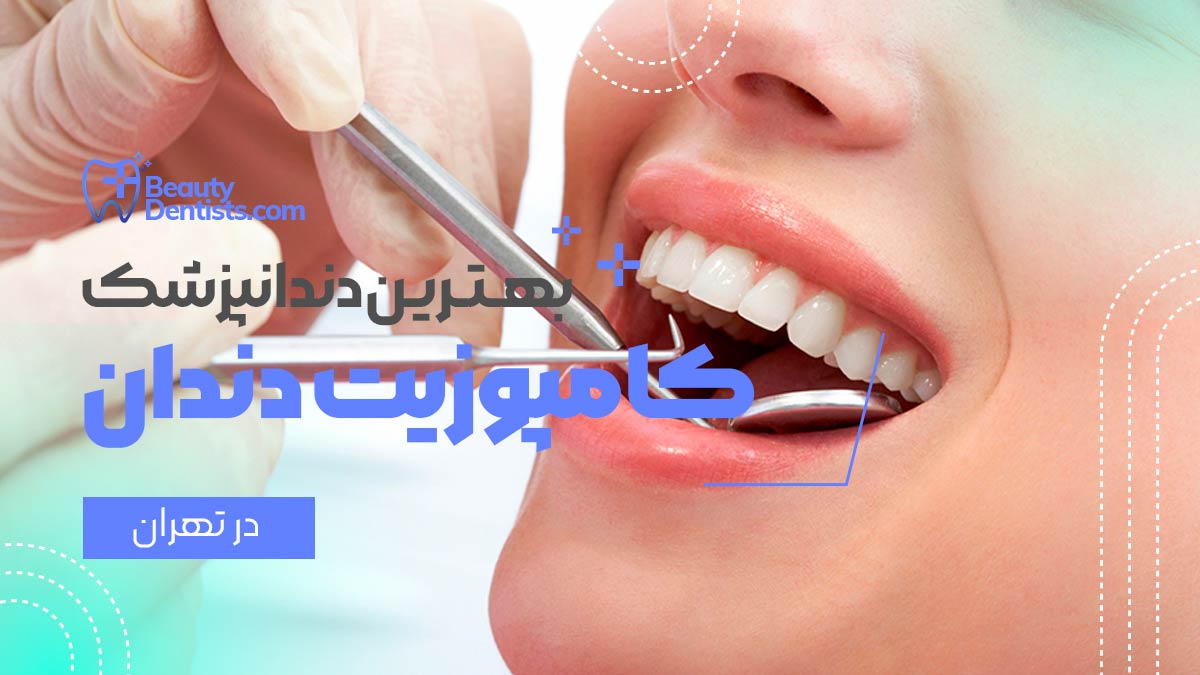 دندانپزشک کامپوزیت دندان اقساطی در تهران